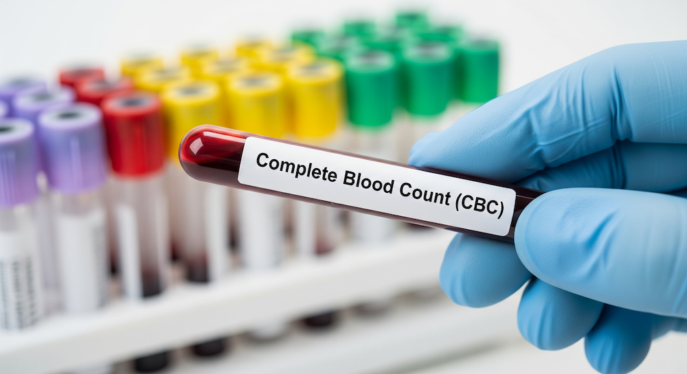 The Complete Blood Count: Clinical Insights & Result Interpretation