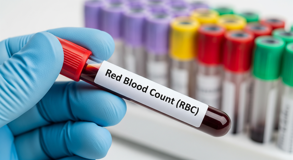 Red Blood Cell (RBC) Count: Diagnostics, Ranges & Anemia Protocols
