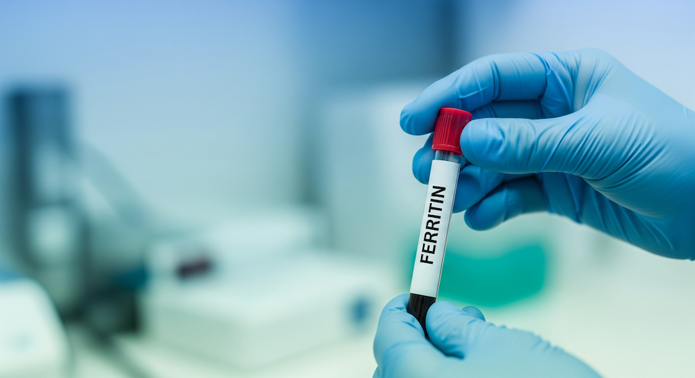 Ferritin Levels Guide: Low Iron Symptoms, Hair Loss & Toxicity