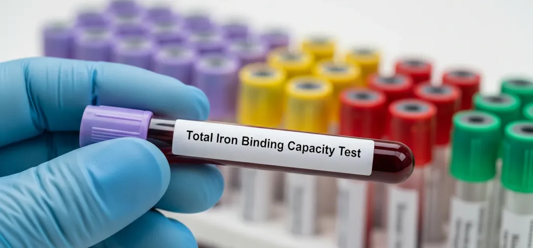 TIBC (Total Iron Binding Capacity): Normal Ranges, Anemia & High Levels